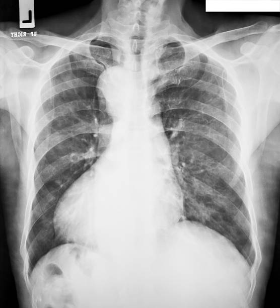 istock collection of x-ray 476915769