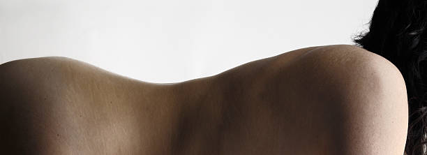 istock naked woman 476943170