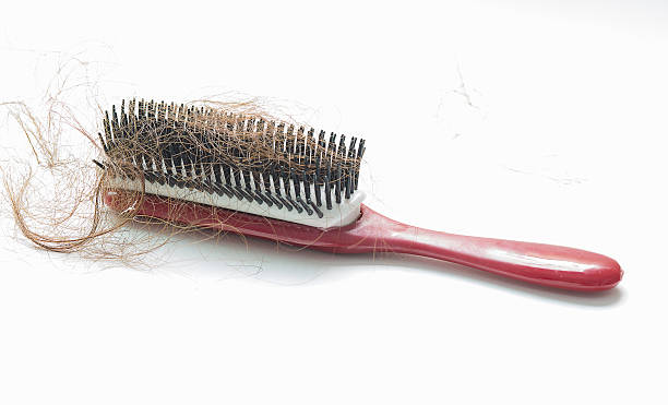 istock Hair fall on a red comb isolated on white background 476968978