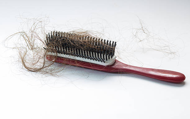 istock Hair fall on a red comb isolated on white background 476968980