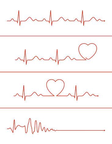 Set of various cardiogram design elements. Cardiogram lines of healthy heart and heart stop