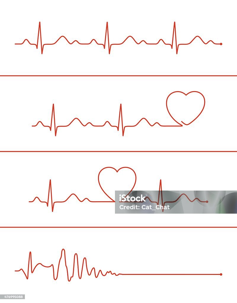 Cardiogram lines set Set of various cardiogram design elements. Cardiogram lines of healthy heart and heart stop Electrocardiography stock vector