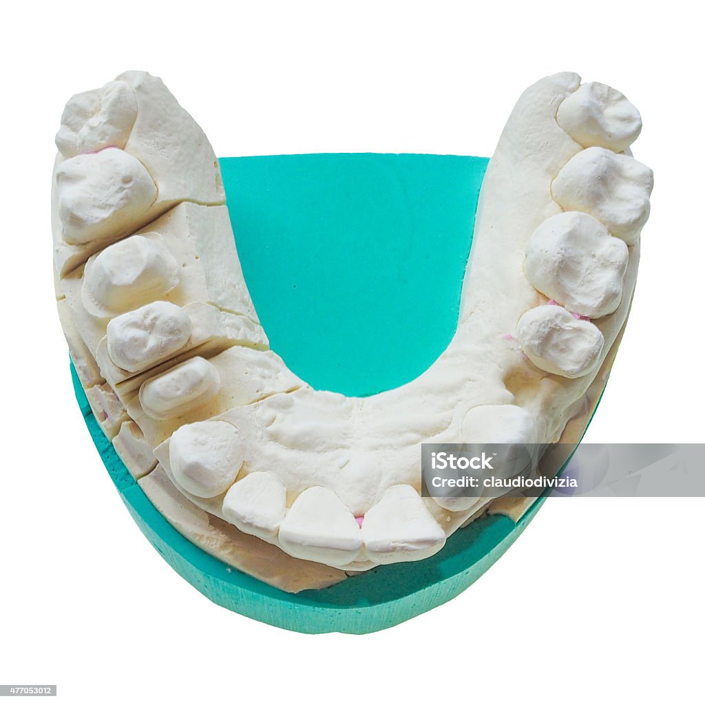 Positive teeth cast Positive dental mould reproduction cast formed from a negative dental impression of teeth isolated over white 2015 Stock Photo