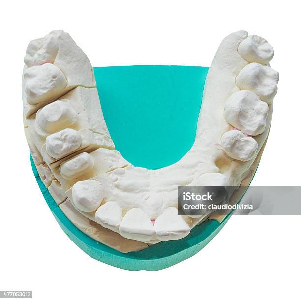 Positive Teeth Cast Stock Photo - Download Image Now - 2015, Dental Health, Dentist