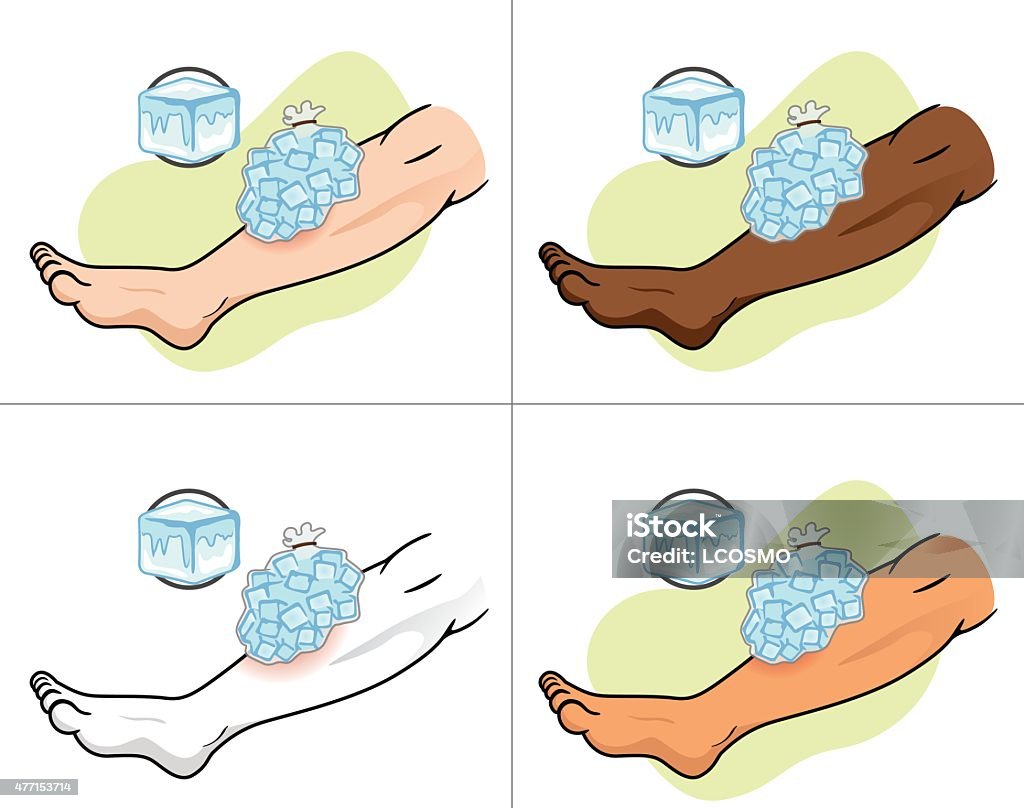 A la verdad sensor Peregrino Ilustración de First Aid Compresa De Hielo Sobre Los Heridos De Piernas y  más Vectores Libres de Derechos de Anatomía - iStock