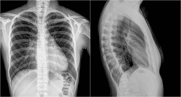 istock Photo of x-ray 477210242