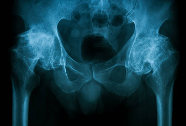 Human body of a man with skeleton for study, on front view, great to be used in medicine works and health. Isolated on a black background. 