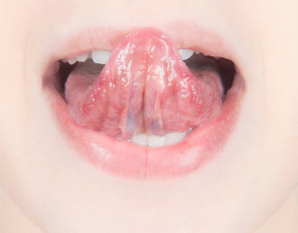 istock funny young woman mouth 477268573