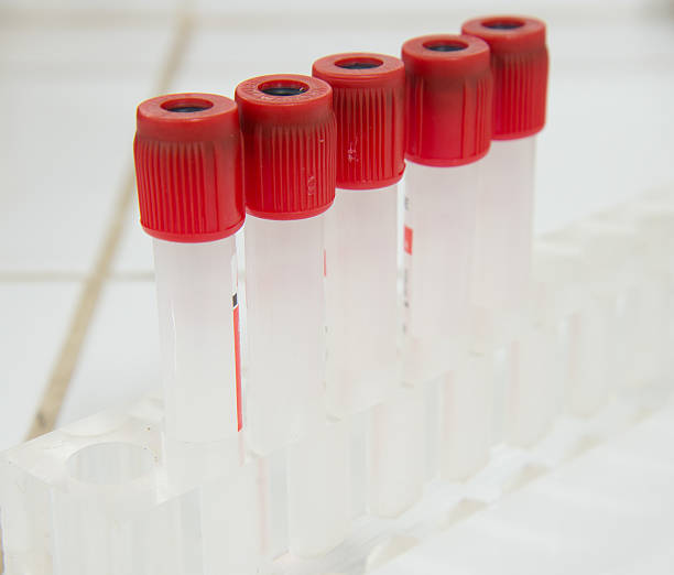 istock tubes prepared in lab centrifuge machine. 477314860