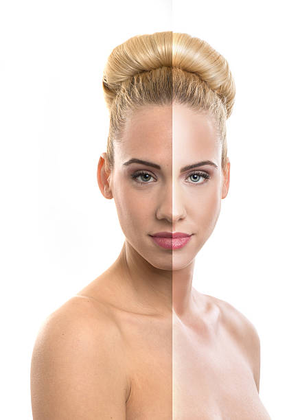 istock Before and after, good - bad beauty retouch. 477385755