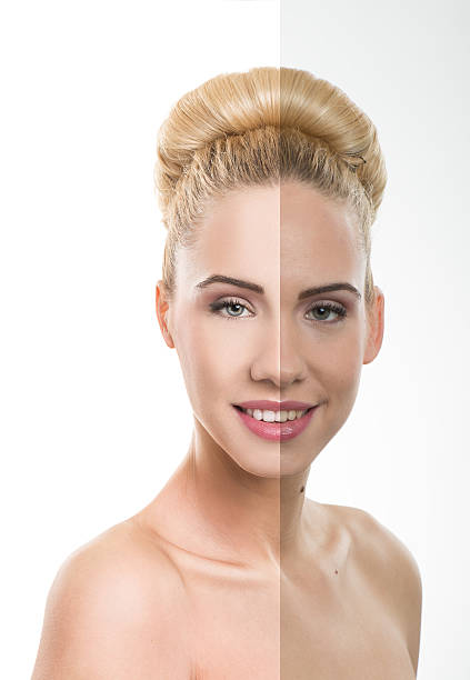 istock Before and after, good - bad beauty retouch. 477416045