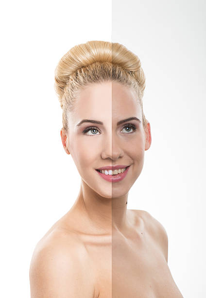 istock Before and after, good - bad beauty retouch. 477416429