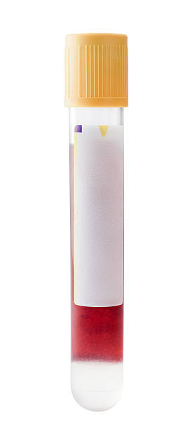 sangue del tubo - blood blood sample blood donation tube foto e immagini stock