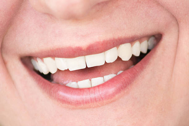 istock Smiling young woman with white teeth 477464674