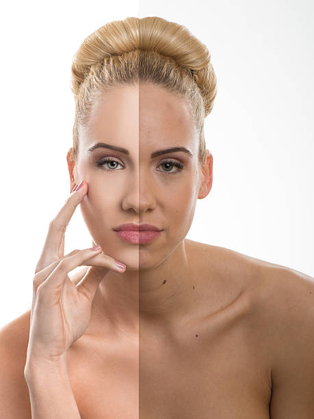 istock Before and after, good - bad beauty retouch. 477546569