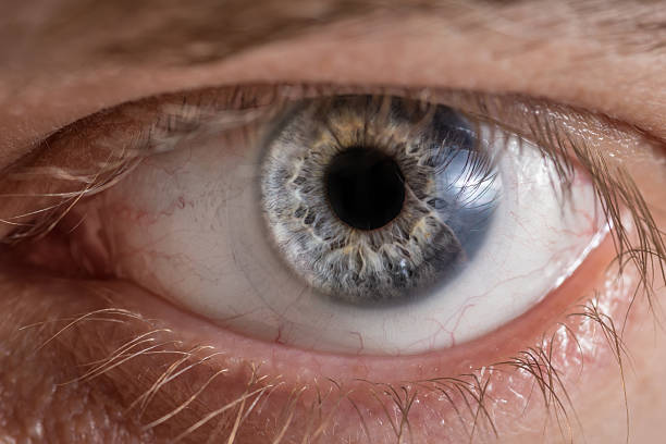istock Eye with contact lens. 477552754