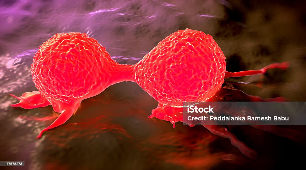 Dividing breast cancer cell Dividing breast cancer cell, showing its uneven surface & cytoplasmic projections. It is in the telophase stage of cell division (mitosis). In this last stage of mitosis, the chromosomes have already been duplicated and distributed to each daughter cell. However, the two daughter cells are still connected by a narrow cytoplasmic bridge. Cancerous (malignant) breast cells form tumours, which possess the ability to invade surrounding tissues. Malignant cells divide rapidly and grow in a chaotic manner. Breast cancer is the most common cause of cancer in women Cancer - Illness Stock Photo