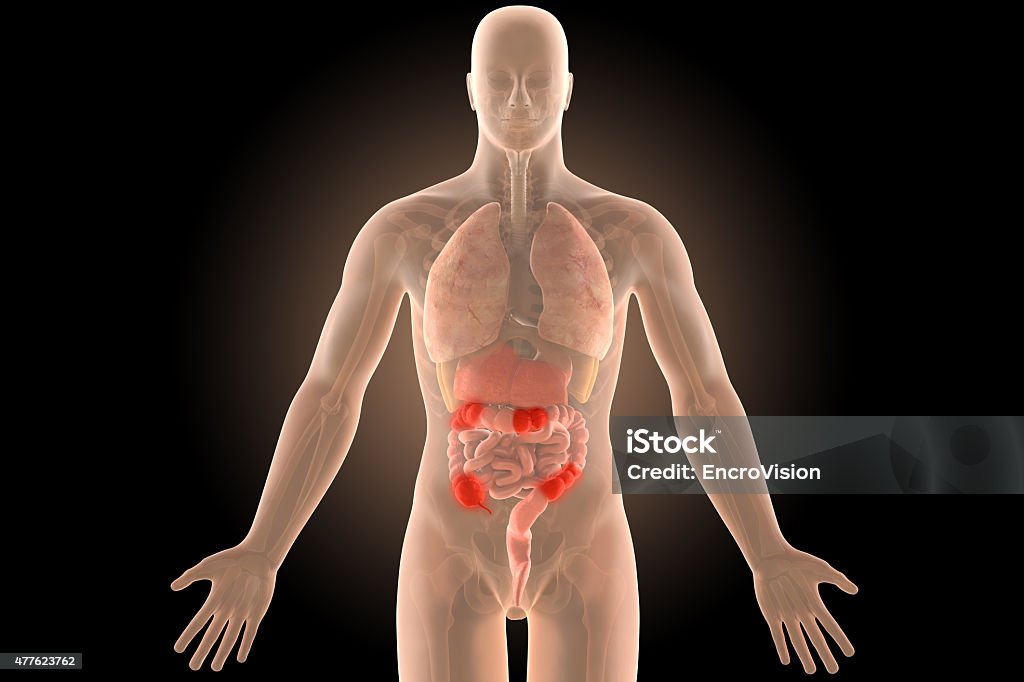 3d human body crohn's infection sites colon with clipping path. Illness Stock Photo