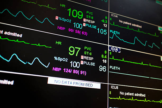 istock Patient monitor icu pulse 477641395