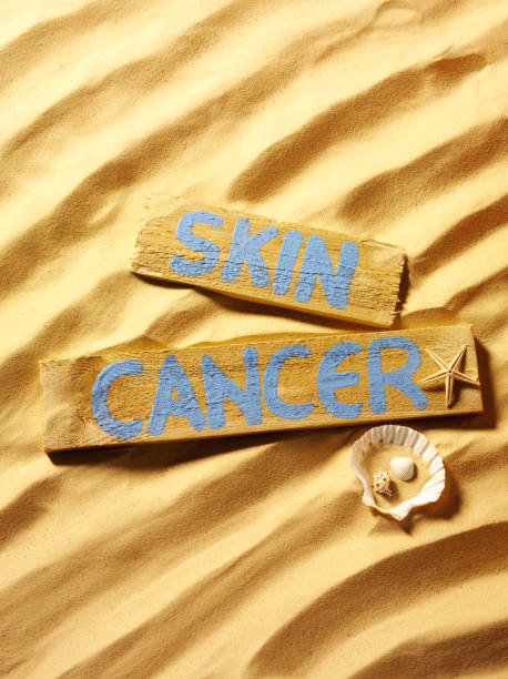 istock Skin Cancer Sign on the Beach 477674939