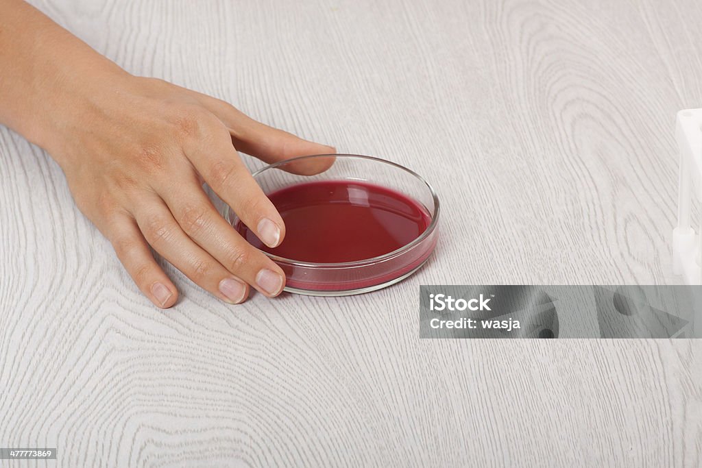 Крови в petri блюда - Стоковые фото Анализировать роялти-фри
