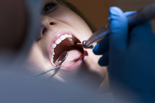 nahaufnahme der offenen mund - mouth open human teeth doctor dental drill stock-fotos und bilder