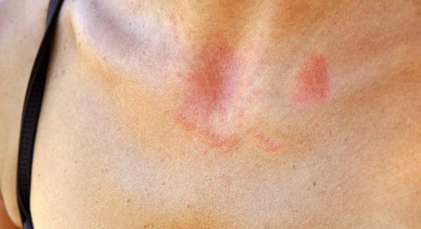 istock women with allergy 477893871
