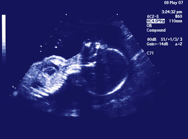 istock Baby Ultra Sound 477911549