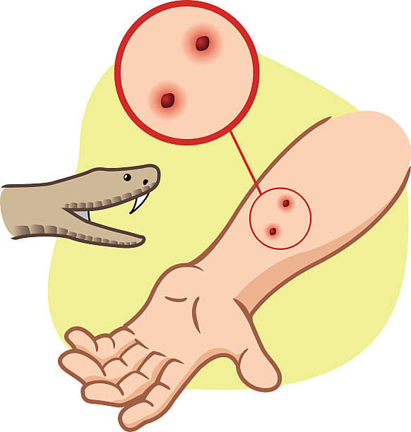 First Aid snake bite on her arm Illustration of a leg receiving first aid, and snake bite on her arm. Ideal for medical supplies, educational and institutional venom symbol stock illustrations