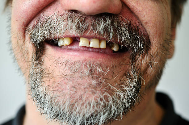 man's face with a smiling toothless stock photo