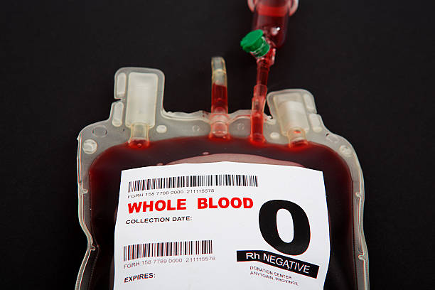 blood transfusion - bloedbank stockfoto's en -beelden