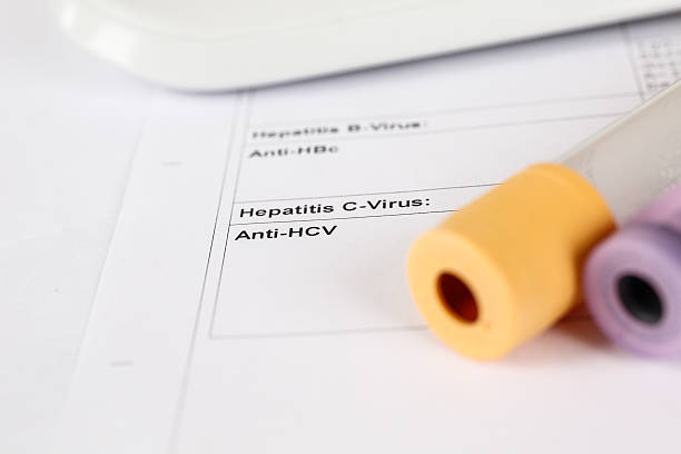Laboratory test, Hepatitis C, blood tubes on paper stock photo