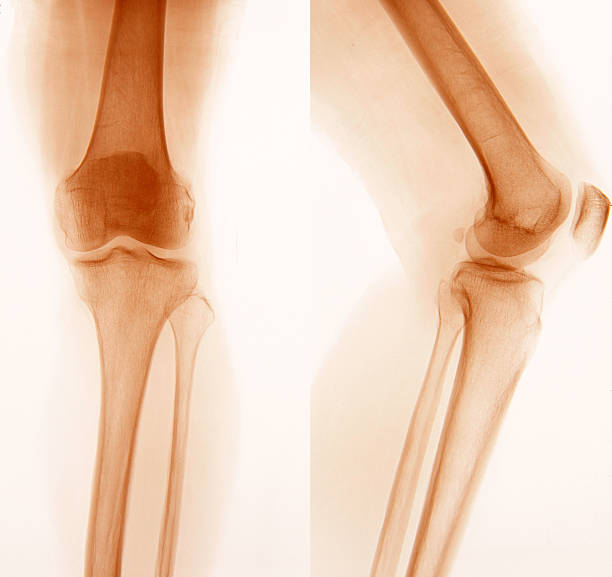 istock X-Ray image of the Foot 478065975