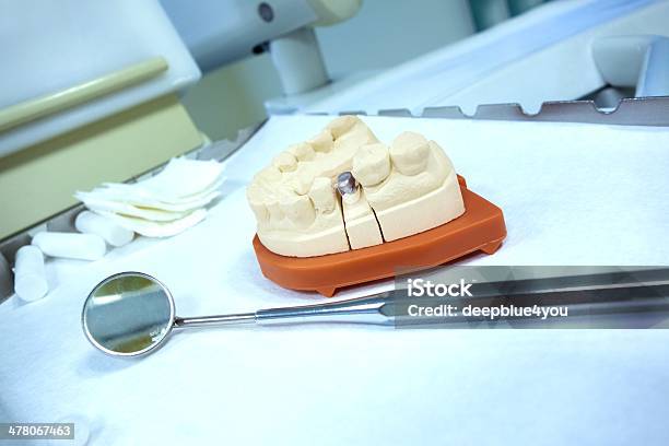 Dental Tools Stock Photo - Download Image Now - Dental Bridge, Tooth Crown, Dental Veneers