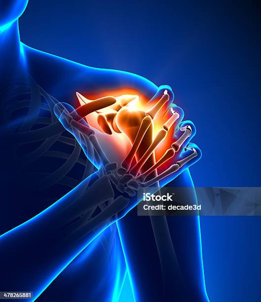 コンピュータで生成されたコンセプトの肩の痛み - X線撮影のストックフォトや画像を多数ご用意 - X線撮影, 肩, 苦痛