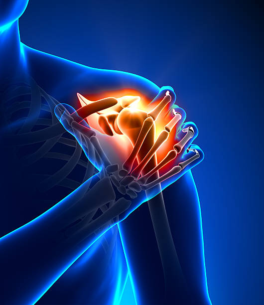 computador gerado conceito de dor no ombro - x ray x ray image shoulder human arm imagens e fotografias de stock