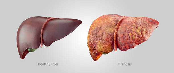 realistische darstellung von gesunden und kranken menschen livers - leber anatomiebegriff stock-fotos und bilder