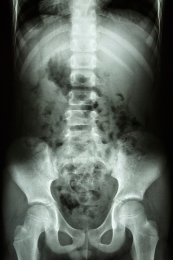 film x-ray show child's spine ,abdomen ,pelvis ,hip