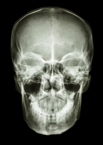 film x-ray skull AP : show normal human's skull