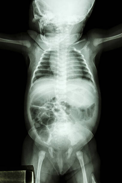 フィルムｘ線インファントの体全体 - human spine anatomy x ray the human body ストックフォトと画像