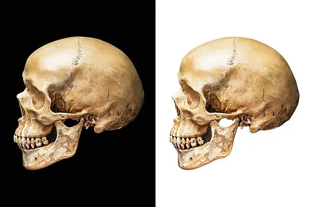 Photo of Human skull isolated