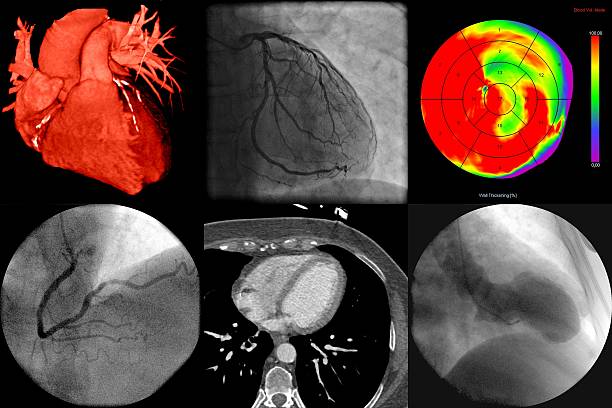 Medical imaging of the heart A series of cardiac imaging with different techniques tomography photos stock pictures, royalty-free photos & images