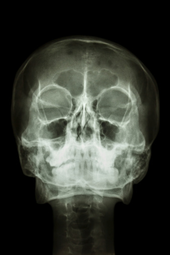 film x-ray skull : show normal human's skull and cervical spine