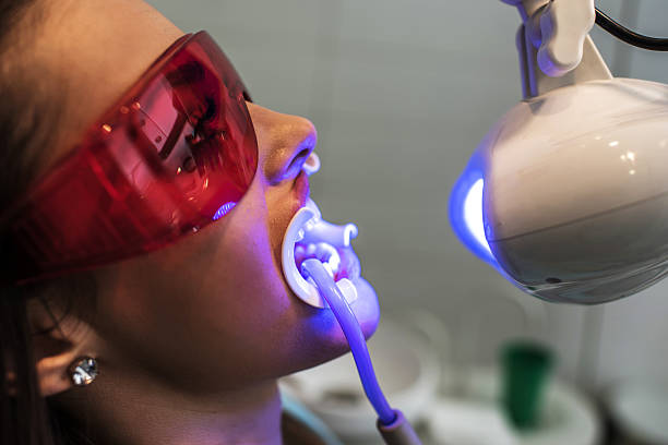 primo piano della luce ultravioletta procedura in ambulatorio dentistico. - human mouth human teeth indoors young women foto e immagini stock