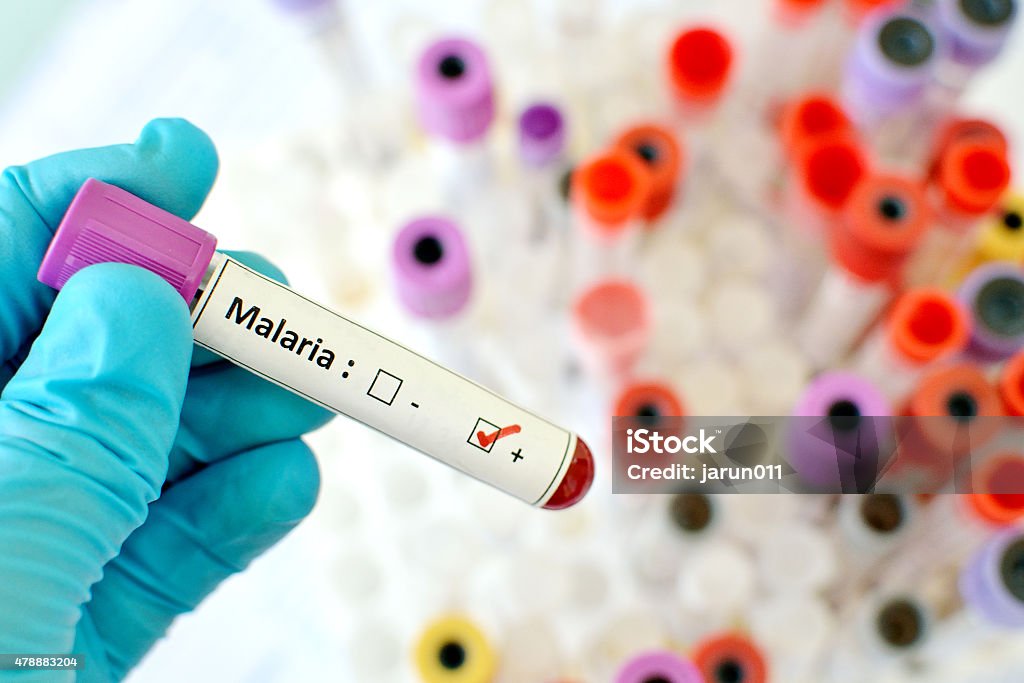 Malaria positive Blood sample with malaria parasite positive Malaria Parasite Stock Photo