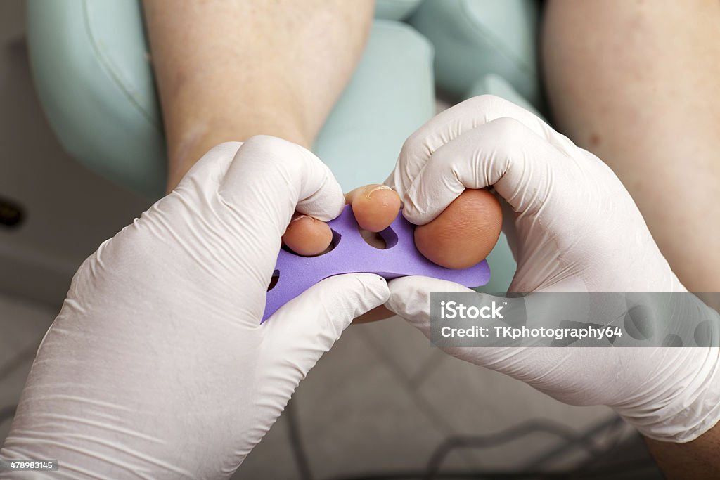 Toenails antes de pintar - Foto de stock de Accesorio personal libre de derechos