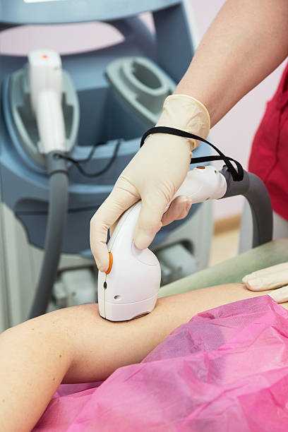 istock photo hair removal 479095004