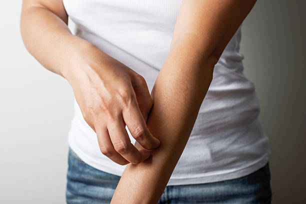 Scratching Scratching, horizontal skin condition photos stock pictures, royalty-free photos & images