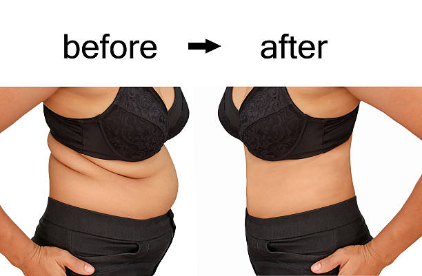 after a diet Woman's body before and after a diet before and after photos stock pictures, royalty-free photos & images