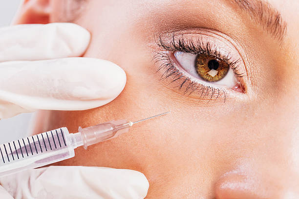 plano aproximado de uma mulher a receber injeção de botox. - surgical needle caucasian aging process white imagens e fotografias de stock